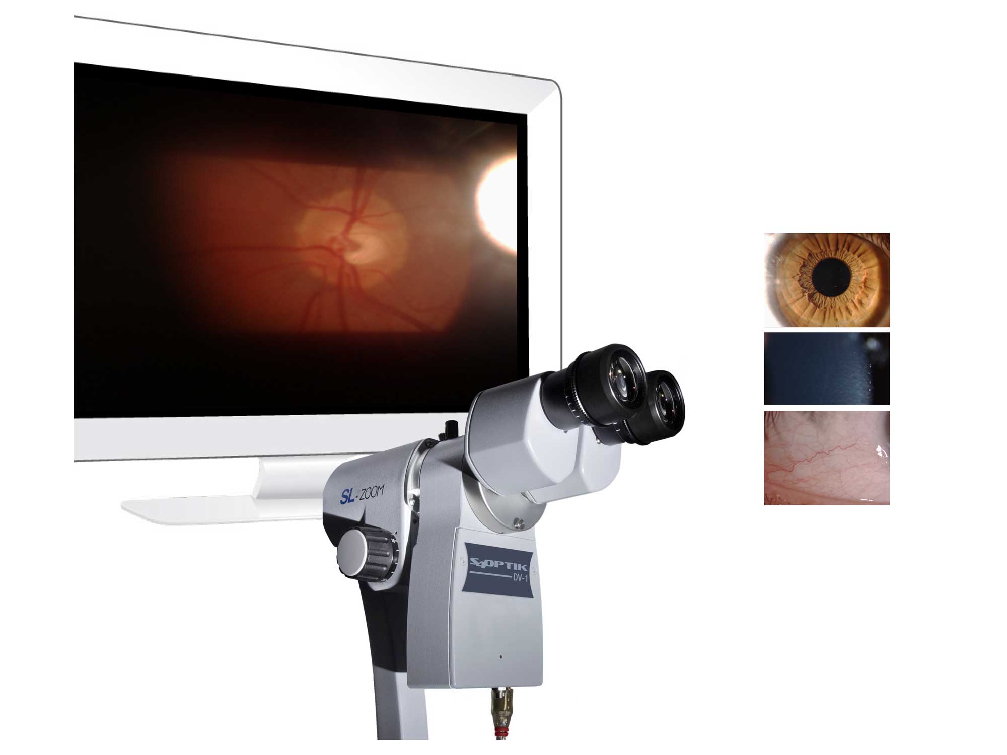 SLIT LAMP IMAGING DV-1