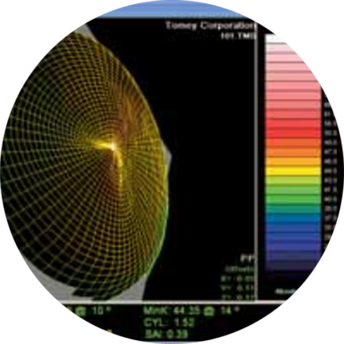 TMS-4N - Mapa topográfico corneal