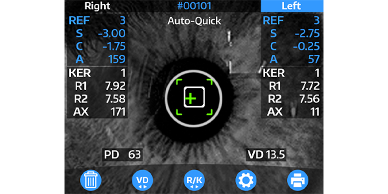 OptoChek Plus - Pantalla de resultados